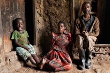 At Ssekyanzi Lawrence's house. The child is 7 years old, he burned himself in the kitchen in 2020, he was operated on in the Children's Surgical Hospital in Entebbe in 2022, where he will soon have a second operation. Ssekyanzi, his mother and his uncle. Kawaala, Busunju, Mityana. Uganda, 2023